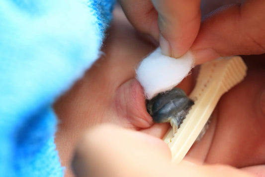 Cleaning the umbilical cord of the baby.
