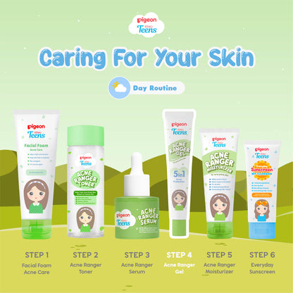 Pigeon Teens Acne Ranger Gel 15ml