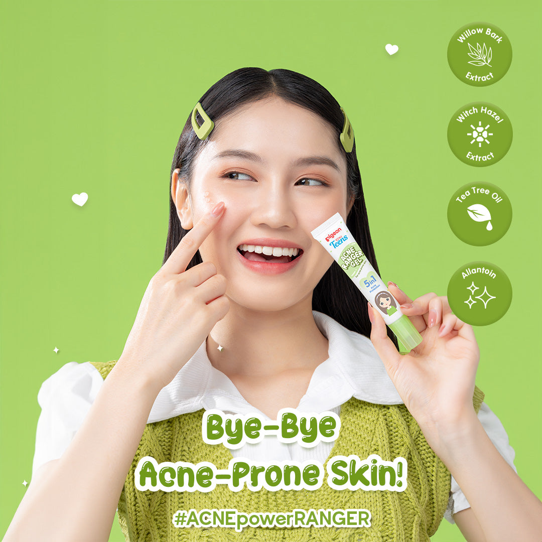 Pigeon Teens Acne Ranger Gel 15ml